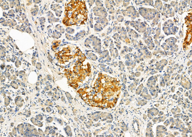 PMEL Antibody in Immunohistochemistry (Paraffin) (IHC (P))