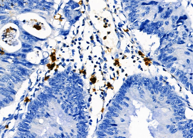 PTBP2 Antibody in Immunohistochemistry (Paraffin) (IHC (P))