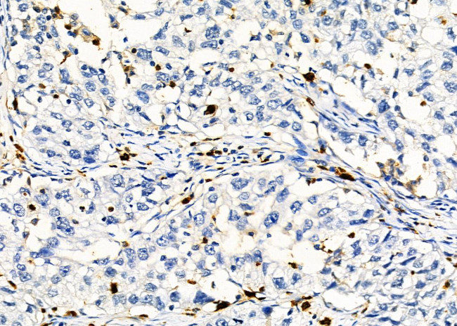 PTBP2 Antibody in Immunohistochemistry (Paraffin) (IHC (P))