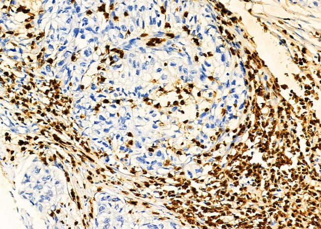 PTBP2 Antibody in Immunohistochemistry (Paraffin) (IHC (P))