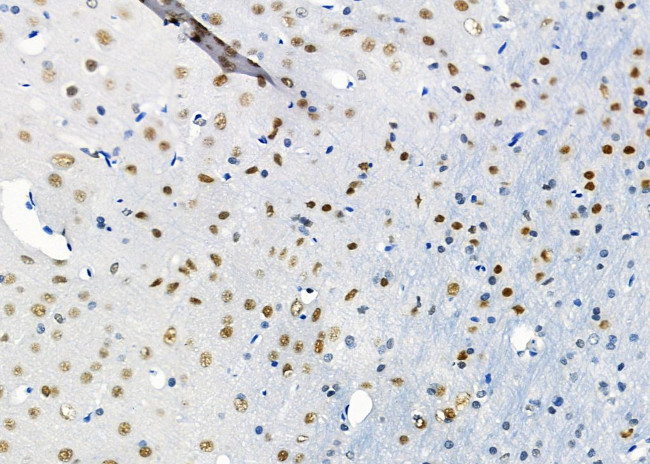 PTBP2 Antibody in Immunohistochemistry (Paraffin) (IHC (P))