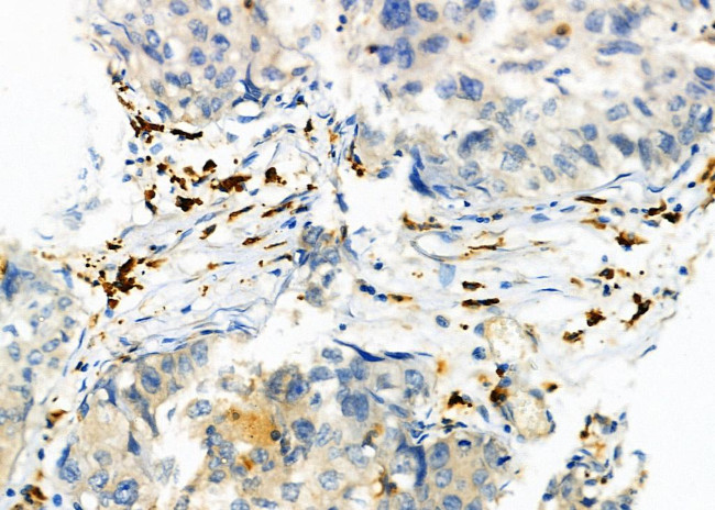 RAB9 Antibody in Immunohistochemistry (Paraffin) (IHC (P))