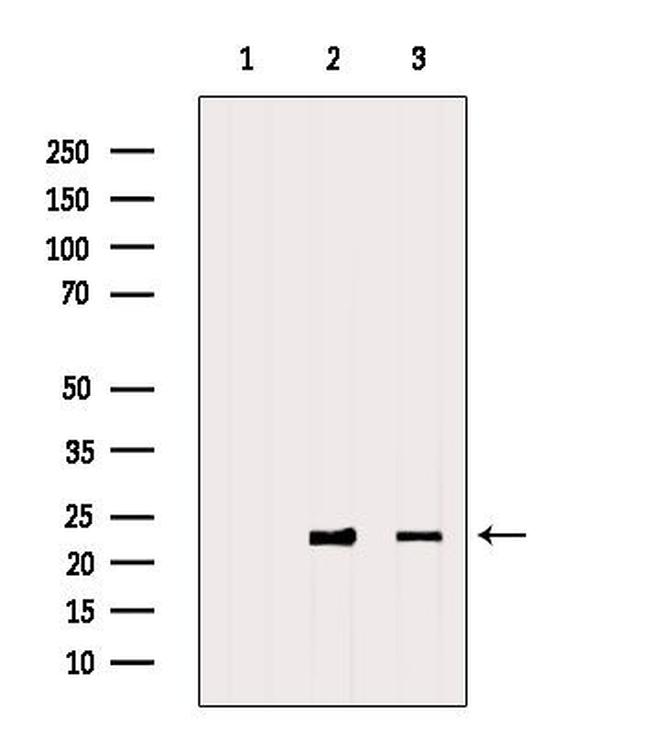 RAB9 Antibody in Western Blot (WB)