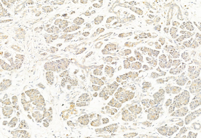 Phospho-DNM1L (Ser637) Antibody in Immunohistochemistry (Paraffin) (IHC (P))