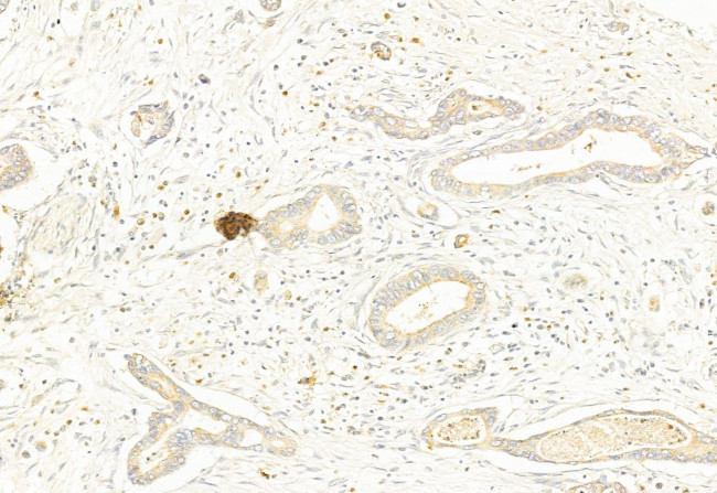 Phospho-DNM1L (Ser637) Antibody in Immunohistochemistry (Paraffin) (IHC (P))