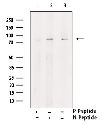Phospho-DNM1L (Ser637) Antibody in Western Blot (WB)