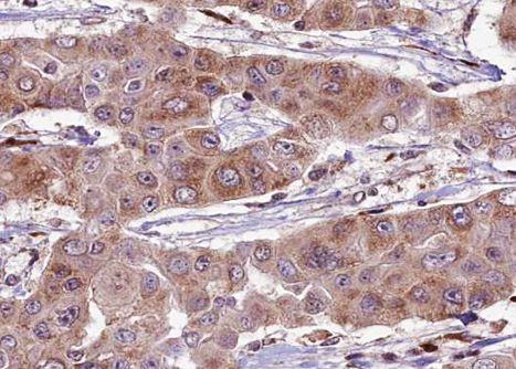 Phospho-DNM1L (Ser637) Antibody in Immunohistochemistry (Paraffin) (IHC (P))