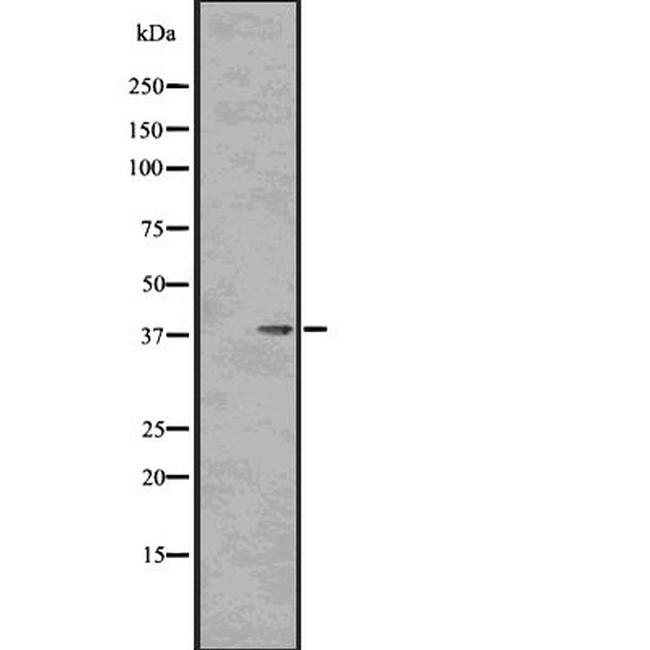 Phospho-PP1 alpha (Thr320) Antibody in Western Blot (WB)