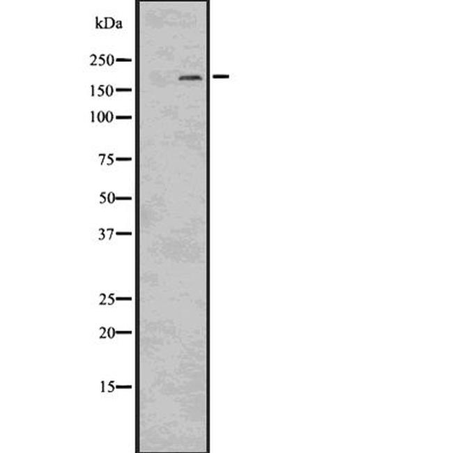 LRP6 Antibody in Western Blot (WB)