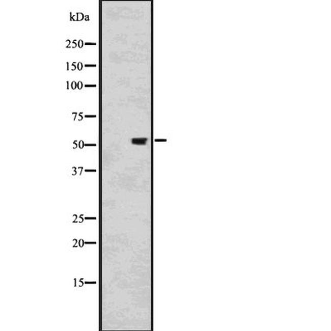 KLF11 Antibody in Western Blot (WB)