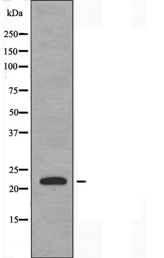 MSC Antibody in Western Blot (WB)