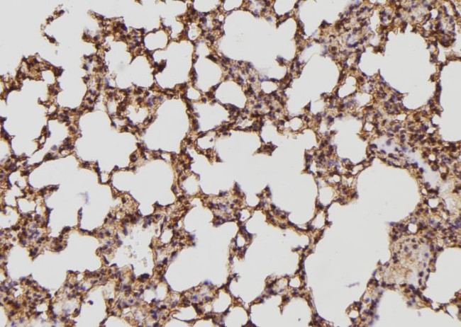 BCAR3 Antibody in Immunohistochemistry (Paraffin) (IHC (P))