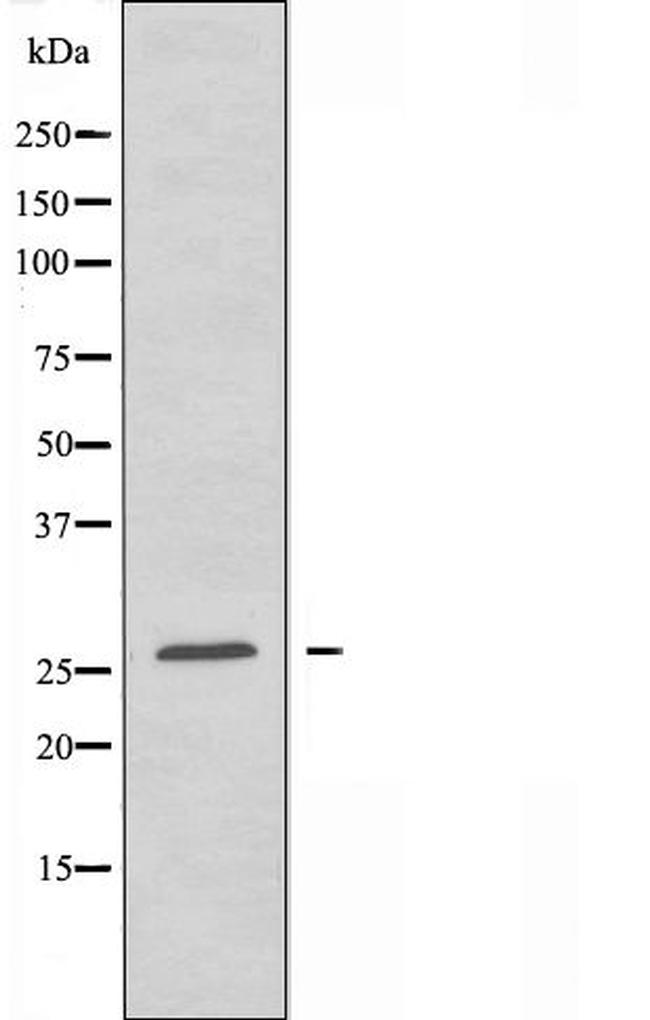 LRAT Antibody in Western Blot (WB)