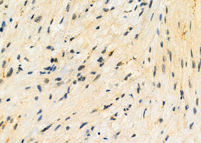 TOP3B Antibody in Immunohistochemistry (Paraffin) (IHC (P))