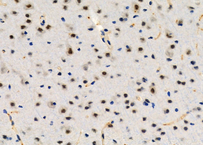 TOP3B Antibody in Immunohistochemistry (Paraffin) (IHC (P))