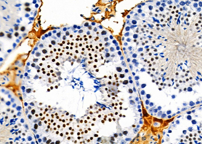 TOP3B Antibody in Immunohistochemistry (Paraffin) (IHC (P))