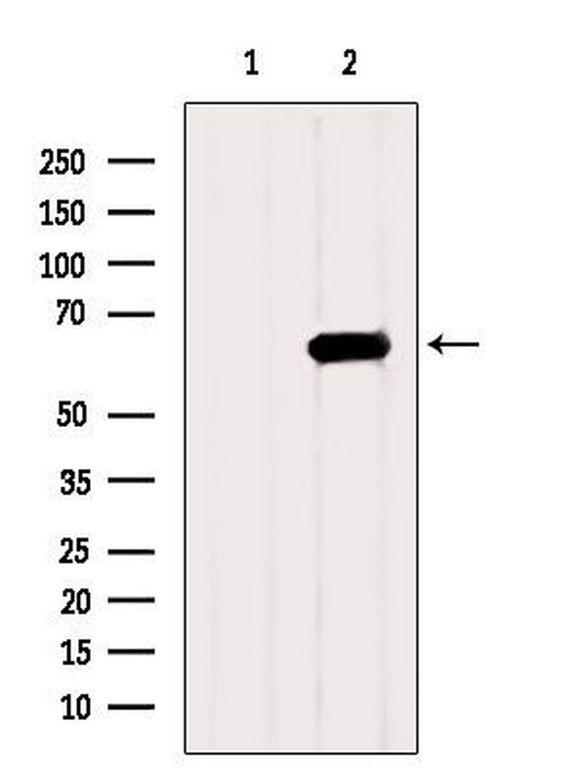 HEXB Antibody in Western Blot (WB)