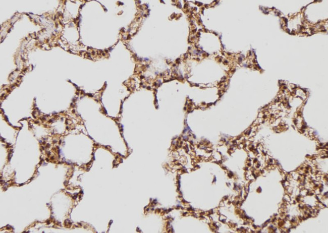 TPT1 Antibody in Immunohistochemistry (Paraffin) (IHC (P))