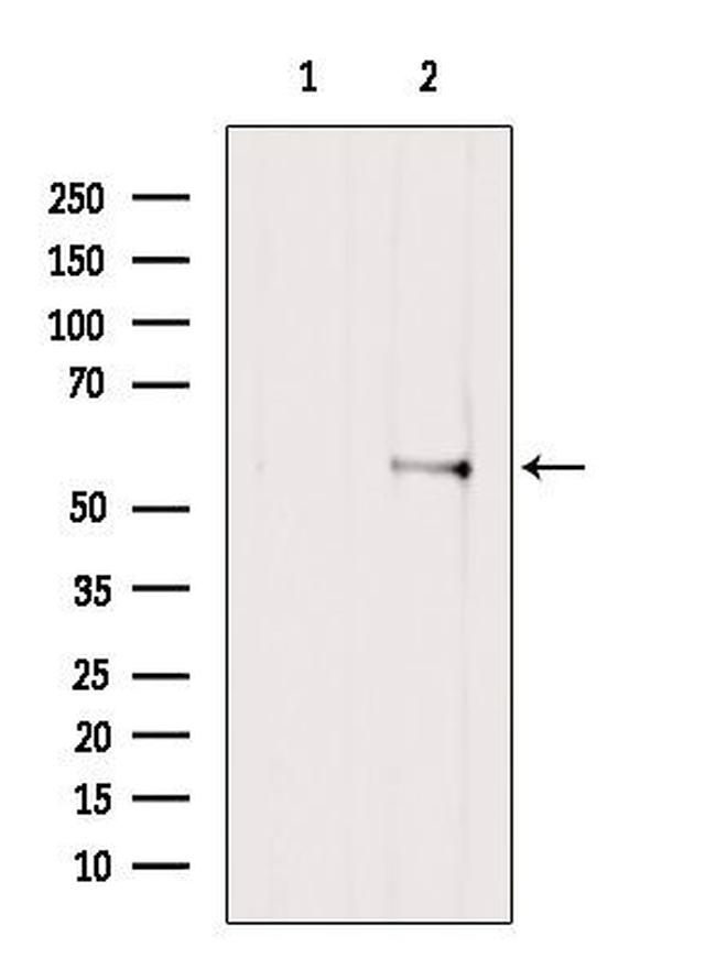 PFKFB1 Antibody in Western Blot (WB)