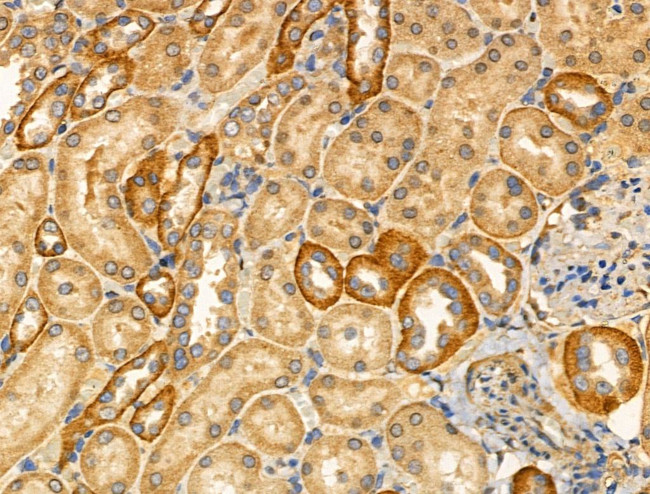 PFKL Antibody in Immunohistochemistry (Paraffin) (IHC (P))