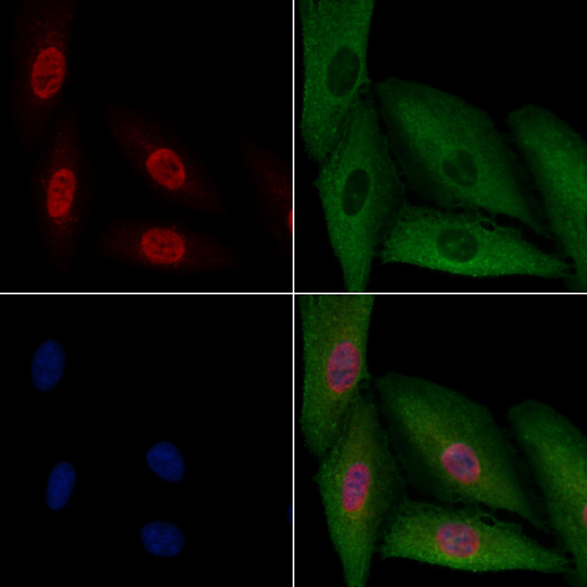 ATF3 Antibody in Immunocytochemistry (ICC/IF)