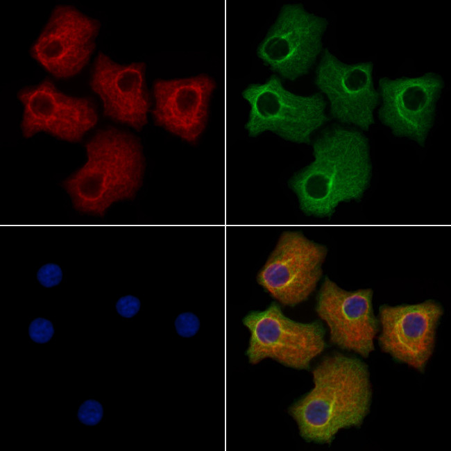 DTYMK Antibody in Immunocytochemistry (ICC/IF)