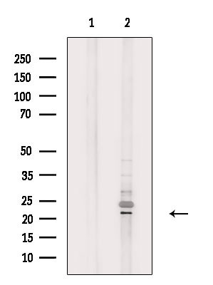 DTYMK Antibody in Western Blot (WB)