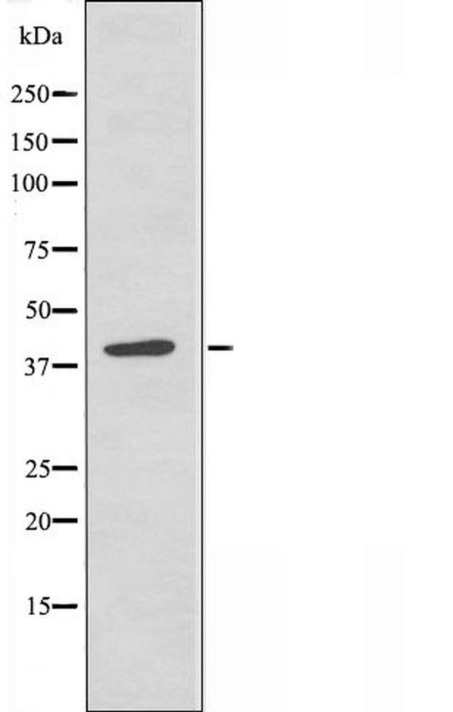 PTX3 Antibody in Western Blot (WB)