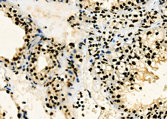 PRKAR1B Antibody in Immunohistochemistry (Paraffin) (IHC (P))