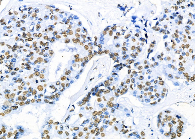 PRKAR1B Antibody in Immunohistochemistry (Paraffin) (IHC (P))