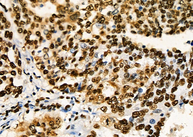 PRKAR1B Antibody in Immunohistochemistry (Paraffin) (IHC (P))