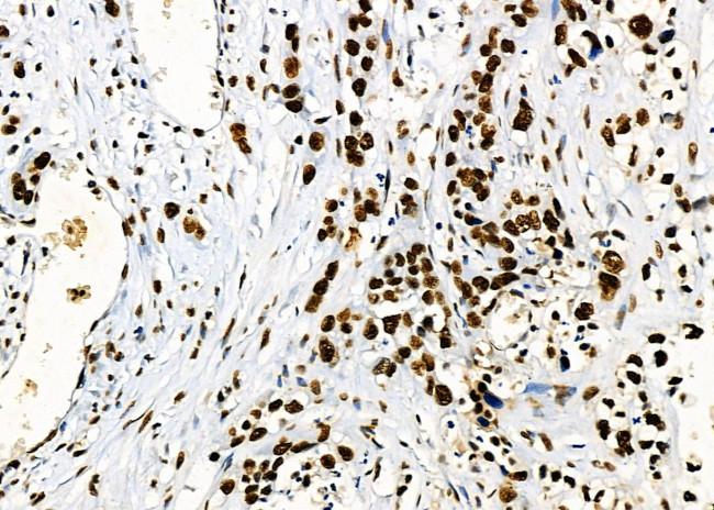 PRKAR1B Antibody in Immunohistochemistry (Paraffin) (IHC (P))