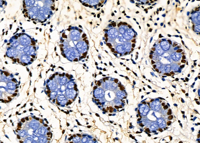 PRKAR1B Antibody in Immunohistochemistry (Paraffin) (IHC (P))