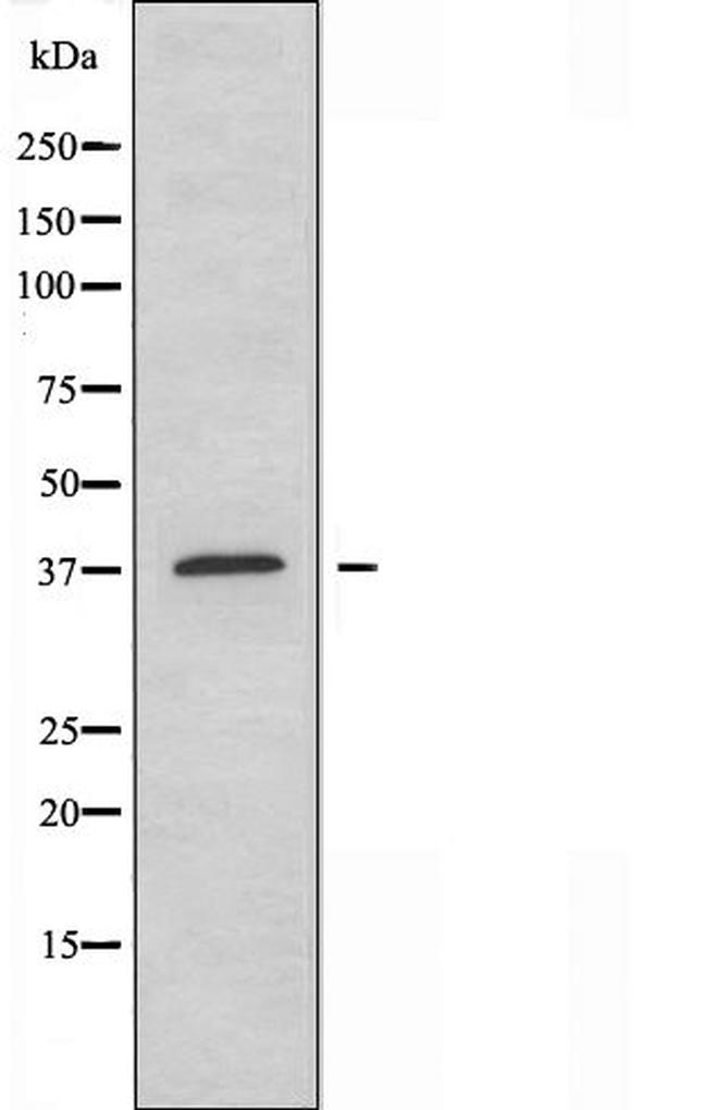 CD153 Antibody in Western Blot (WB)