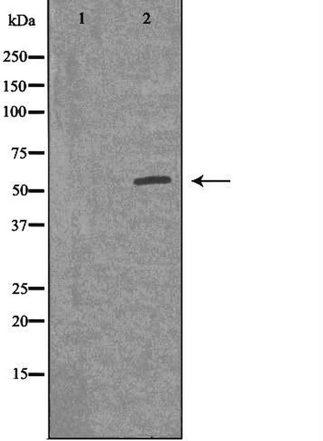 ACVR1B Antibody in Western Blot (WB)