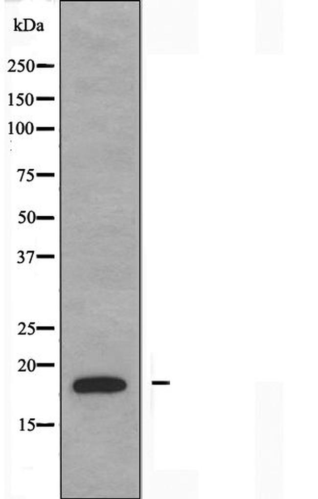 NBL1 Antibody in Western Blot (WB)