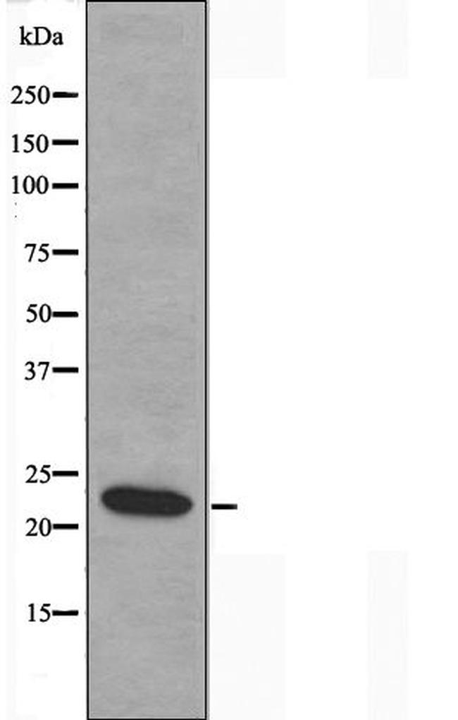 4-1BB Ligand Antibody in Western Blot (WB)