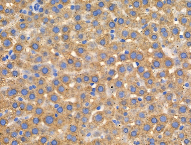 FRK Antibody in Immunohistochemistry (Paraffin) (IHC (P))