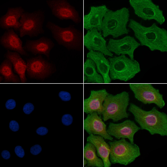 ETV1 Antibody in Immunocytochemistry (ICC/IF)