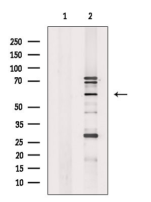 ETV1 Antibody in Western Blot (WB)