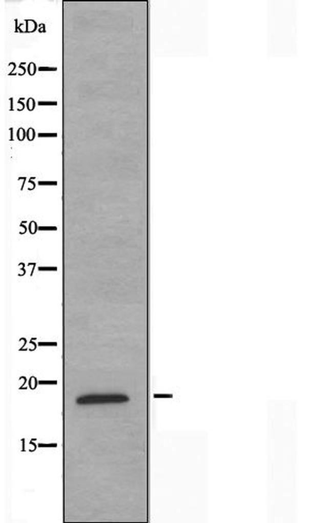 NCBP2 Antibody in Western Blot (WB)