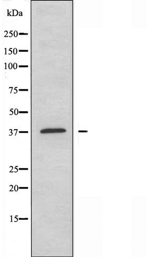 EFNA3 Antibody in Western Blot (WB)