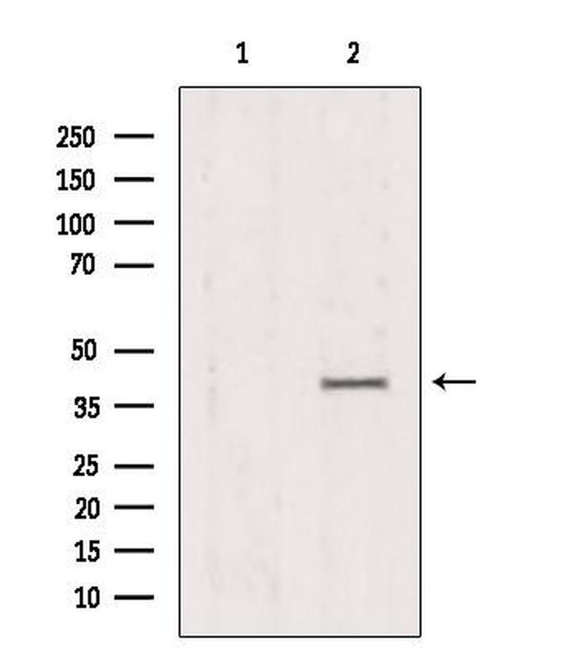 AMPK gamma-1,2,3 Antibody in Western Blot (WB)