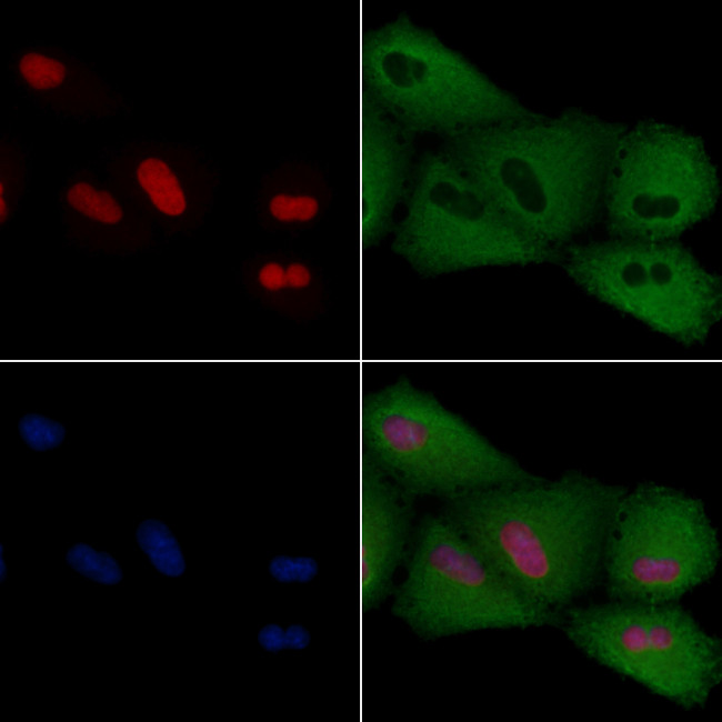 PITX1 Antibody in Immunocytochemistry (ICC/IF)