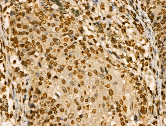 PITX1 Antibody in Immunohistochemistry (Paraffin) (IHC (P))