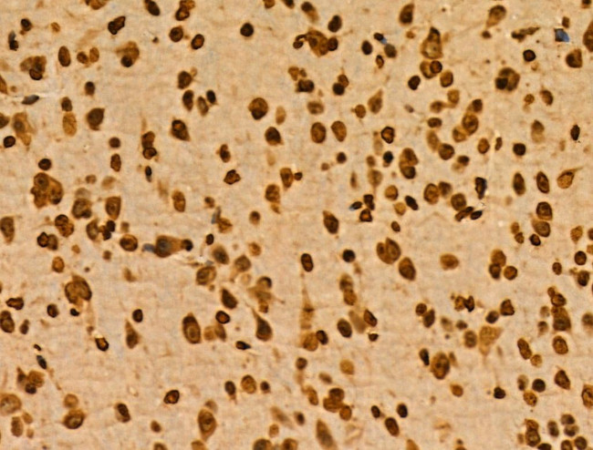 PITX1 Antibody in Immunohistochemistry (Paraffin) (IHC (P))