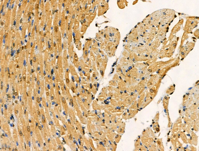 PITX1 Antibody in Immunohistochemistry (Paraffin) (IHC (P))