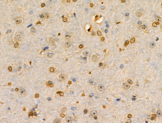 PITX1 Antibody in Immunohistochemistry (Paraffin) (IHC (P))