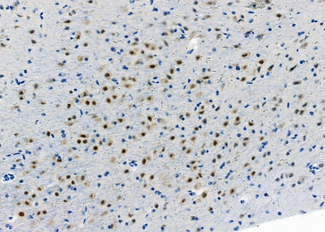 ADARB1 Antibody in Immunohistochemistry (Paraffin) (IHC (P))