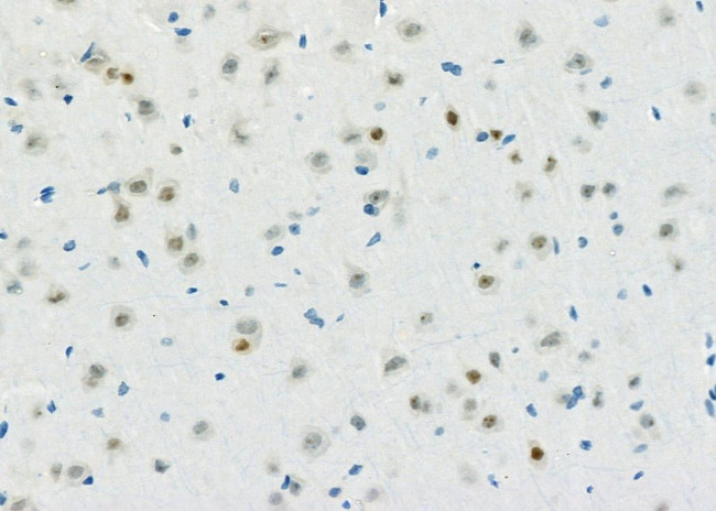 ADARB1 Antibody in Immunohistochemistry (Paraffin) (IHC (P))